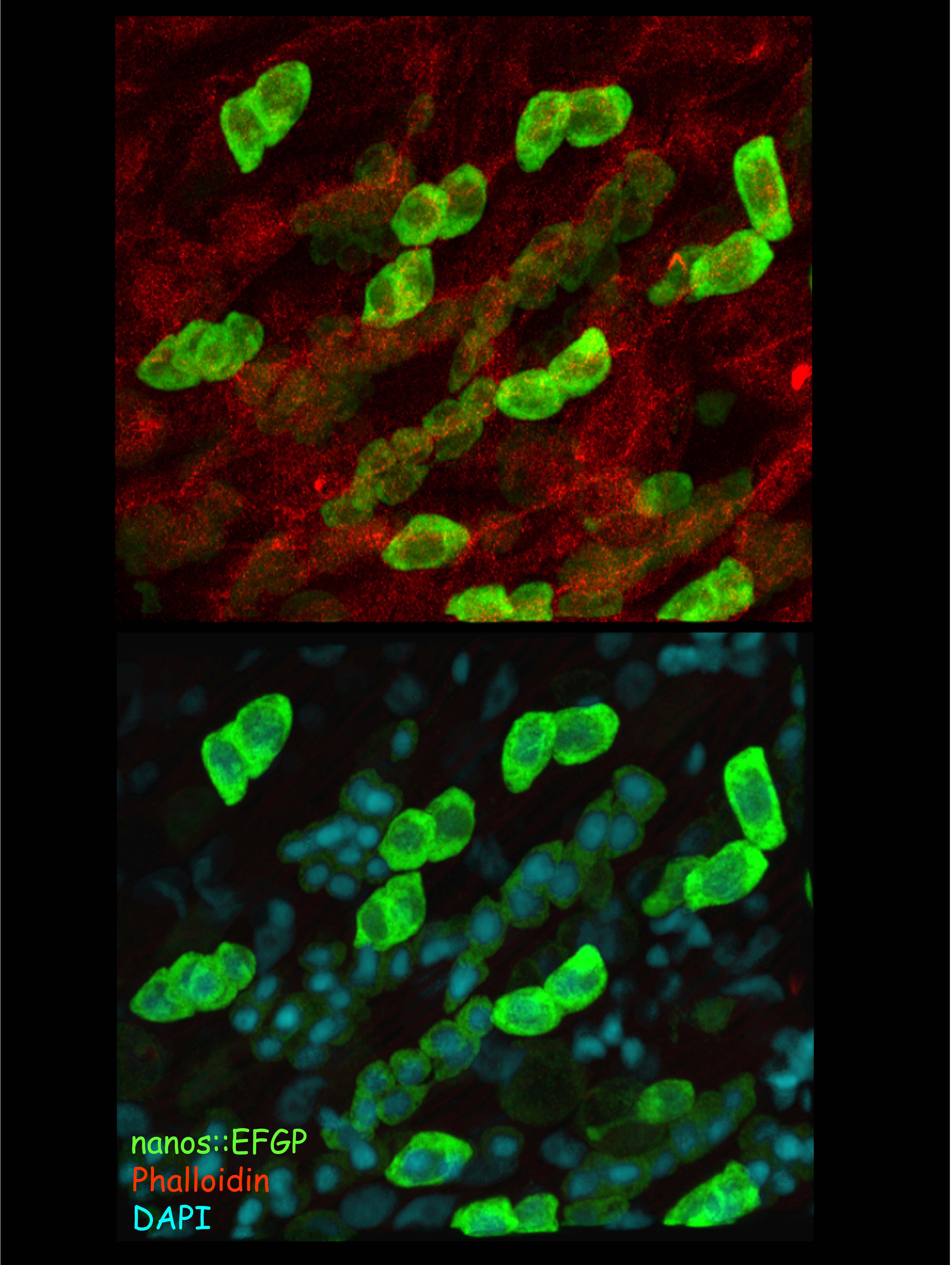 Interstitial stem cells of Hydra visualized by nanos::EGFP reporter. EFGP signal away in the developing nematoblasts. Photo by Dr. Friederike Anton-Erxleben.