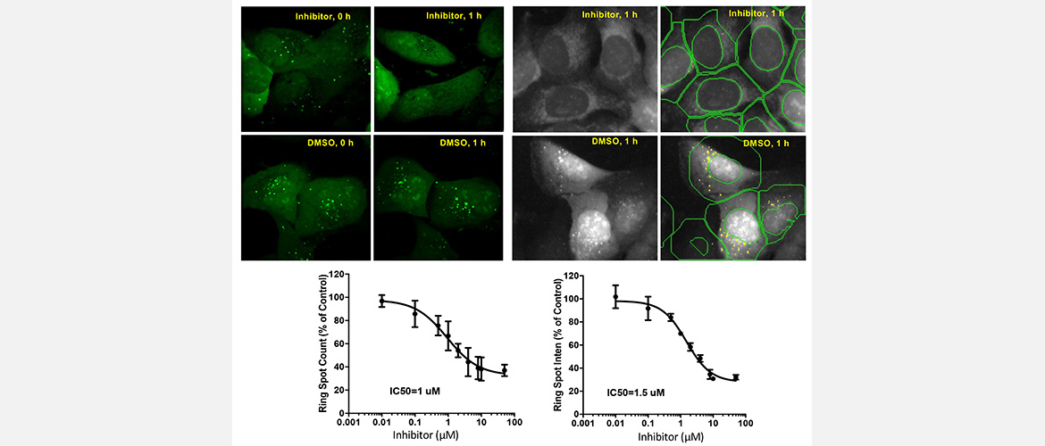 We established a cell-based screening system to identified potential treatments for FGFR3 overactivated diseases.