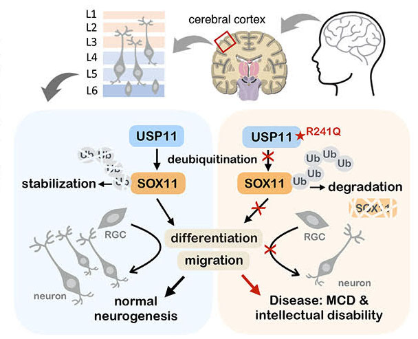 Usp11 controls cortical neurogenesis and neuronal migration through Sox11 s