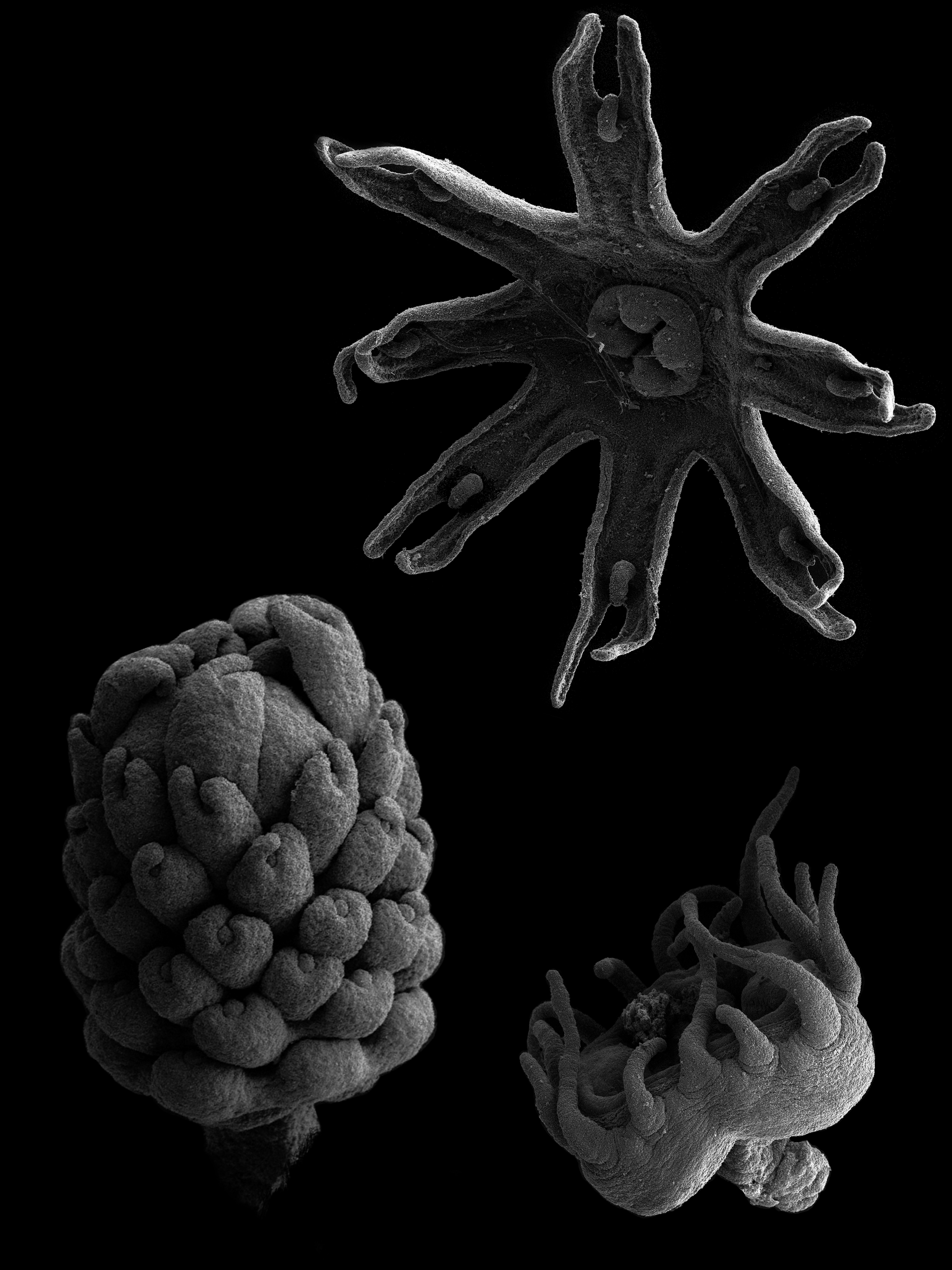 Life cycle stages of Aurelia jellyfish - polyp, strobila and ephyra. Photo by Dr. Friederike Anton-Erxleben